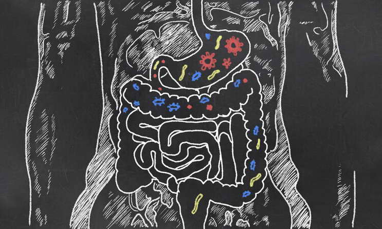 有一種致命的粗心叫“把結腸癌當闌尾炎”！6個症狀都要認清