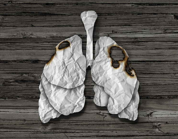 如果沒有香菸，肺癌將是一種罕見癌症