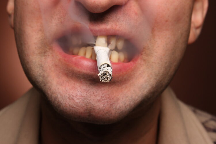100个菸民中，最终会有多少人得肺癌？数字可能让你感到意外