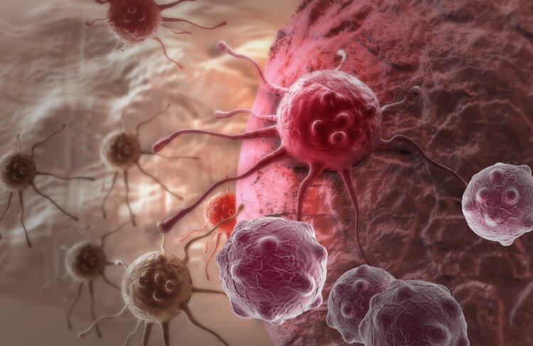 人人都有癌细胞，为什么有人会得癌？3种做菜习惯或致癌，请远离